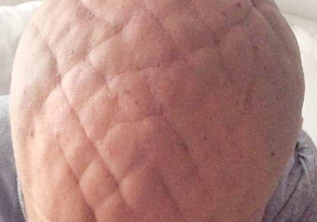 Burri 37-vjeçar me kokën më të pazakontë në botë 1 6