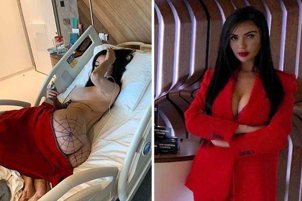 Do të jetë si Kim Kardashian, vajza heq 8 brinjë dhe shpenzon gjysmë milion paund me ndërhyrje kirurgjikale Kim