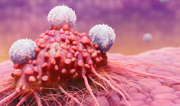 Gjithnjë e në rritje rastet e kancerit të penisit, ja shenjat që paralajmërojnë rrezikun Penis cancer symptoms Six warning signs that could indicate you have the disease 1391942