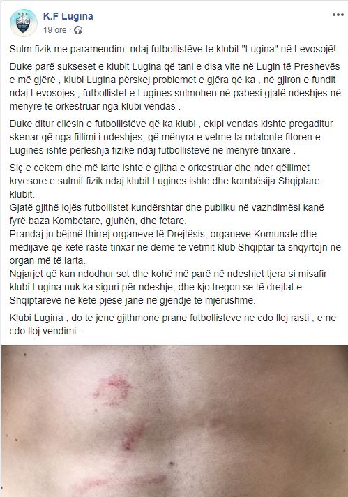 Akte raciste ndaj shqiptarëve në Serbi, ekipi i Luginës pre e fyerjeve dhe e dhunës deklarata e lugines