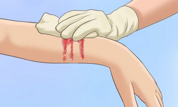 Sekreti/ Si të ndaloni gjakëderdhjen brenda 10 sekondave duke përdorur këtë erëz Gjakederdhjen