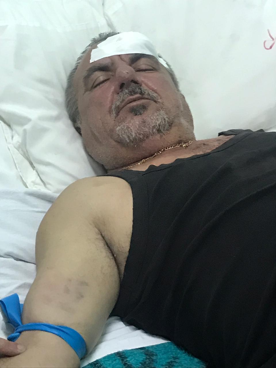 FOTO/ “Më goditën me radio e grushte”, 61-vjeçari denoncon dhunën e patrullës së policisë 2 ef017b19 b3da 409a 8a6d 56bb8a053388
