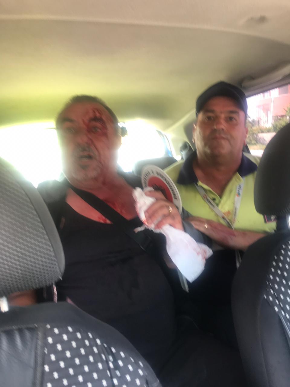 FOTO/ “Më goditën me radio e grushte”, 61-vjeçari denoncon dhunën e patrullës së policisë 1 policia 6