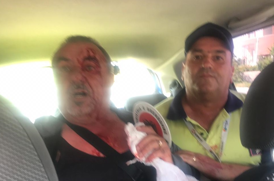 FOTO/ “Më goditën me radio e grushte”, 61-vjeçari denoncon dhunën e patrullës së policisë policia 7