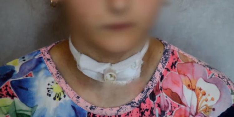 “Dua të jetoj dhe unë si shoqet e mia”, rrëfimi tronditës i 12-vjeçares që merr frymë me anë të një tubi Mjek 750x375 1
