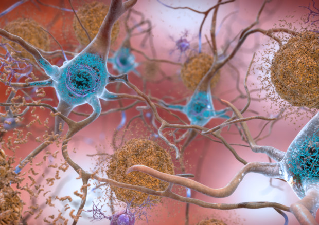 Pse gratë janë më të rrezikuara nga Alzheimeri? kancer