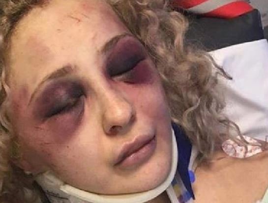 “Kur u zgjova mendova se kisha pësuar aksident” Britney Bashforth 1