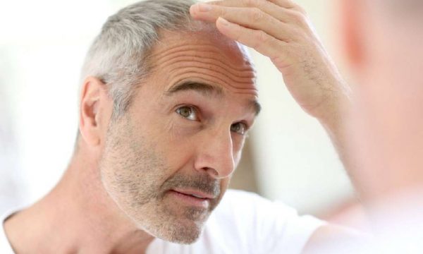 Këto probleme shëndetësore ndikojnë në thinjen e parakohshme të flokëve Should You Dye Your Gray Hair Picture 1 1024x682