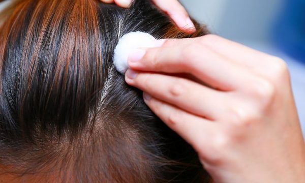 Gjashtë gabimet trashanike që çojnë në yndyrosjen e flokëve aid1433021 v4 728px Treat an Oily Scalp and Dry Roots Step 11