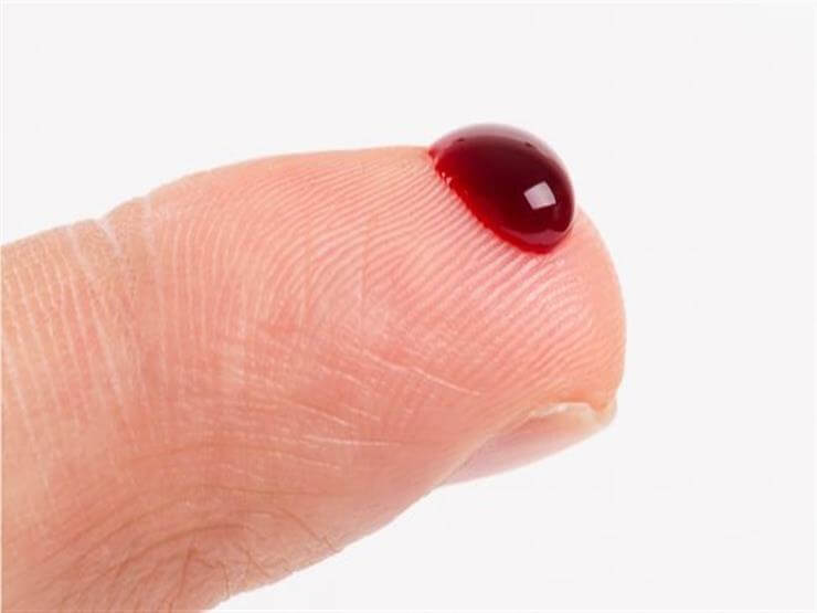 Infeksioni në gjak, një mit që duhet rrëzuar gjaku