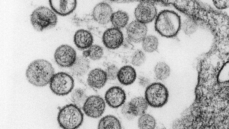 “Hantavirus në qarkullim”? Ekspertja shuan zërat: Nuk është virus i ri, mjafton të mos hani… 1 230 780x439 770x433 1