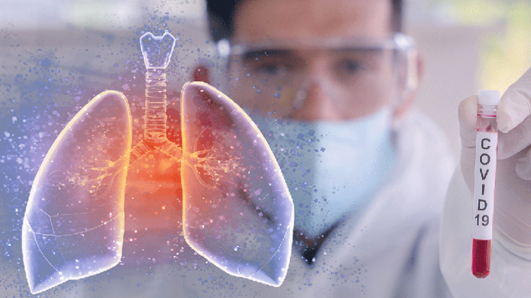Ja pse janë më të rrezikuar shqiptarët nga COVID-19 Coronavirus lungs test tube 780x439 770x433 1