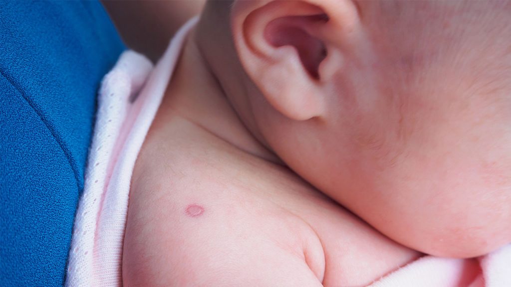 A mundet që vaksina kundër tuberkulozit (TB) të forcojë sistemin imunitar ndaj koronavirusit të ri? TB Vaccines Coronavirus 1280x720