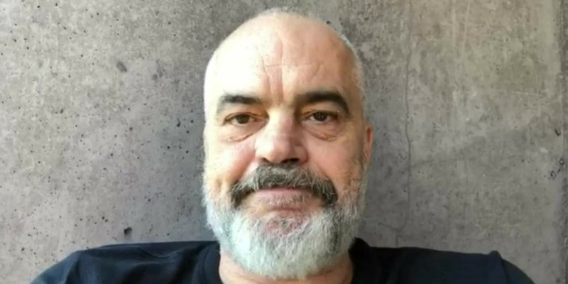 Si do të përdoren tamponët për testin e koronavirusit? Rama sqaron qytetarët edi rama 1
