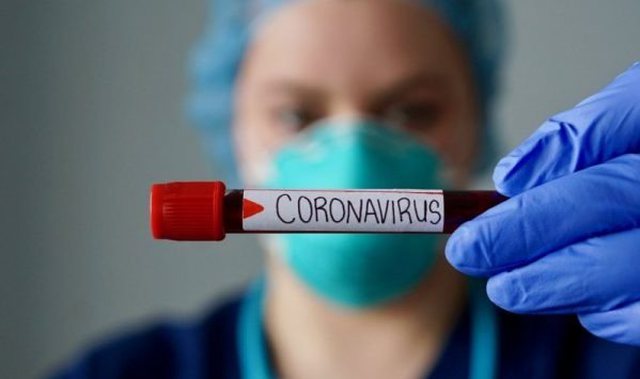 E vërteta e vdekjes së 85-vjeçarit në Shkodër. Reagon edhe Ministria e Shëndetësisë 640 0 5e90758190e91