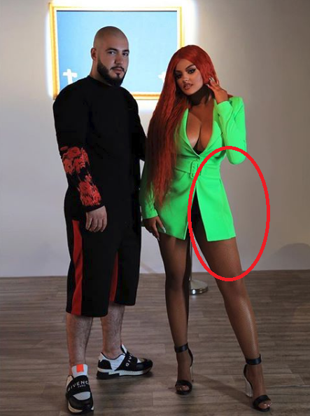 Përdorimi i tepruar i “photoshop”, Enca përfundon në mediat britanike 3 enca