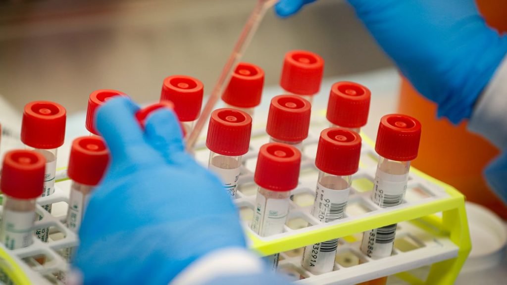 “Sekretet”e Pekinit? Si u shkaktua pandemia, disa skenarë për zgjidhjen e problemeve globale https cdn.cnn .com cnnnext dam assets 200311235712 04 coronavirus outbreak 0311 tests 1024x576 1