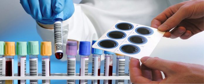 Nga sot nis testimi serologjik, procedura sesi do të kryhet test serologjik 696x287 1