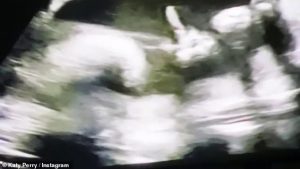 28251884 0 Put that finger down Katy shared her scan and noticed something a 60 1589189990964
