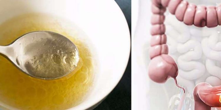 Shkencëtarët kanë gjetur një vaj magjik që pastron qelizat e kancerit të zorrës së trashë 90% në 2 ditë ZORRE E TRASHE