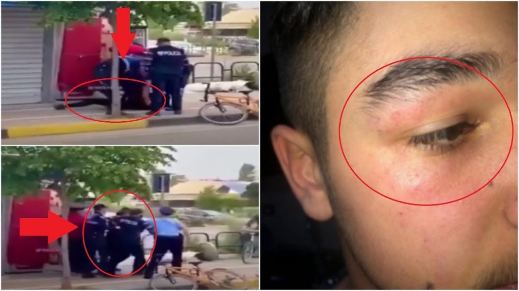 Dhuna ndaj 15-vjeçarit tek Liqeni, Prokuroria nis hetimet ndaj policit Dhuna ndaj minorenitparkuliqenit 15vjecari