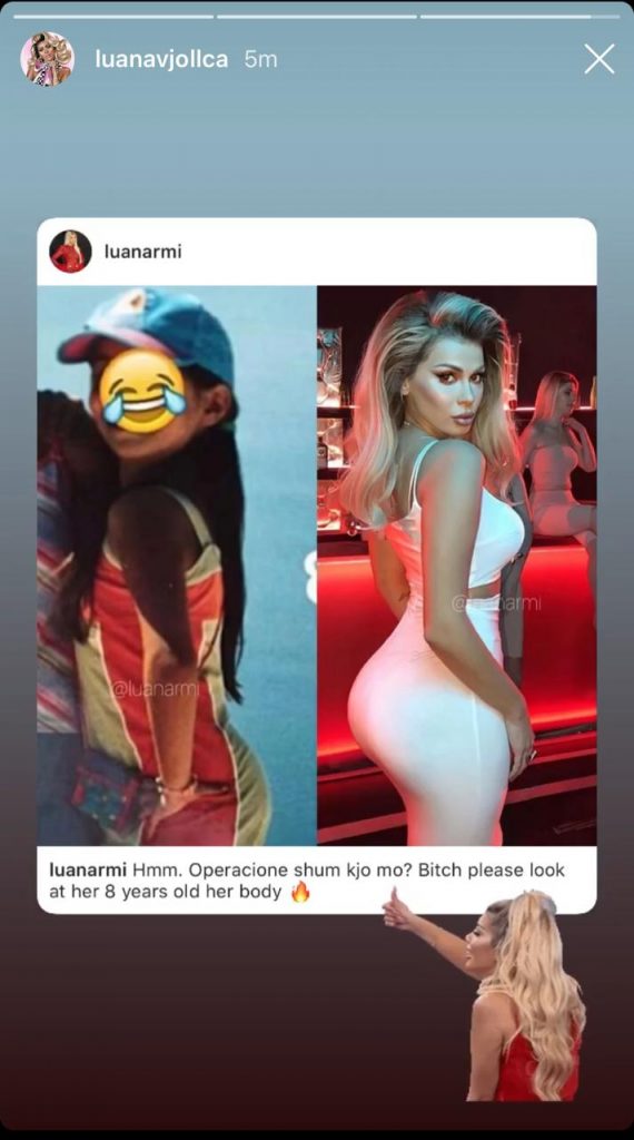 Luana akuzohet për shumë operacione plastike, por kjo foto nga fëmijëria sipas moderatores hedh poshtë të gjitha pretendimet 1 Luana 1
