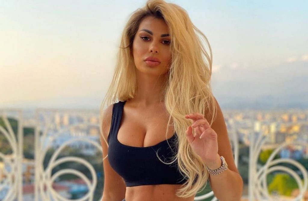 Luana akuzohet për shumë operacione plastike, por kjo foto nga fëmijëria sipas moderatores hedh poshtë të gjitha pretendimet Luana Vjollca 1