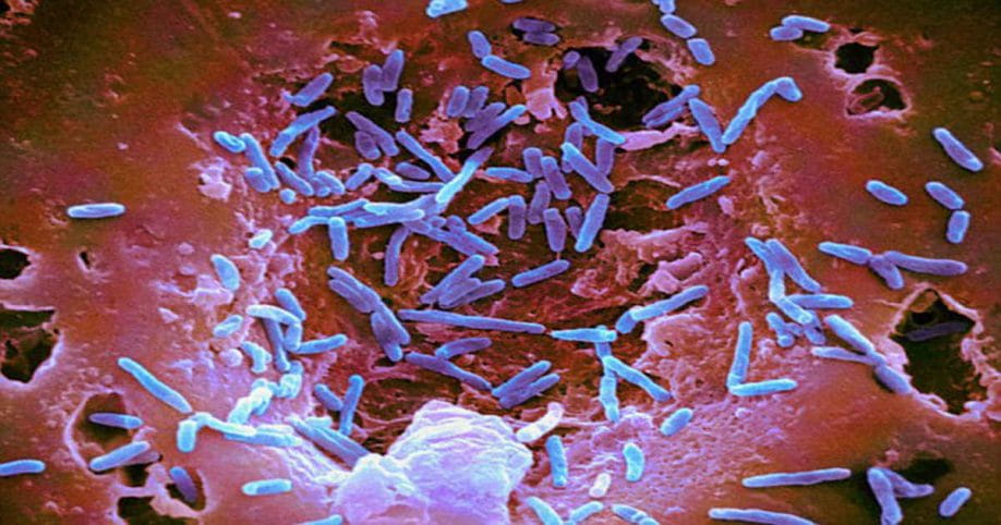 E dinit? Stresi, depresioni dhe ankthi lehtësohen nga probiotikët gut bacteria and mood 918x482 1