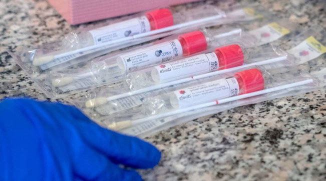 Ja si duhet të veprojnë personat e shëruar nga koronavirusi nëse shfaqin sërish simptoma korona