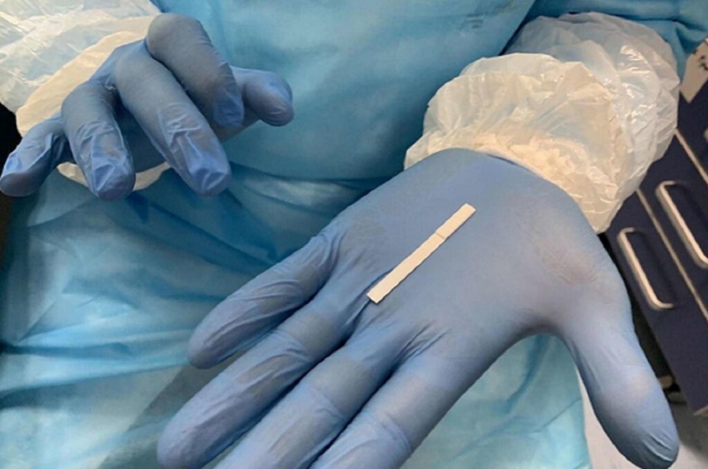Në vetëm tre minuta, Italia krijon testin e shpejtë që zbulon COVID-19 përmes pështymës tampon peshtyme