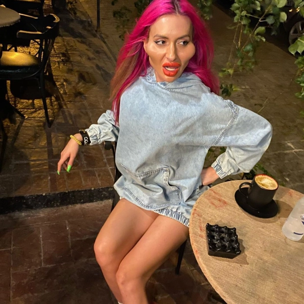 Modelja e Instagramit me mollëzat më të mëdha në botë: I adhuroj ato, gjithmonë kam dashur të dukem kështu! 4 4