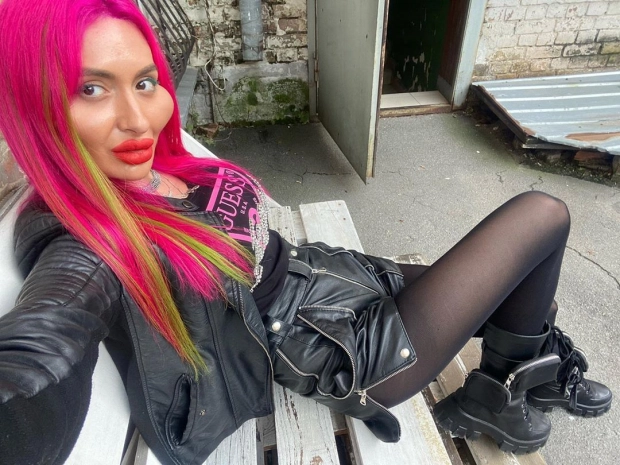 Modelja e Instagramit me mollëzat më të mëdha në botë: I adhuroj ato, gjithmonë kam dashur të dukem kështu! 3 5 1