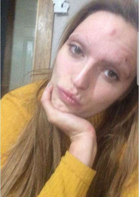 Foto/ Shihni si ka ndryshuar kjo vajzë pasi vendosi të linte drogën 1 5 4