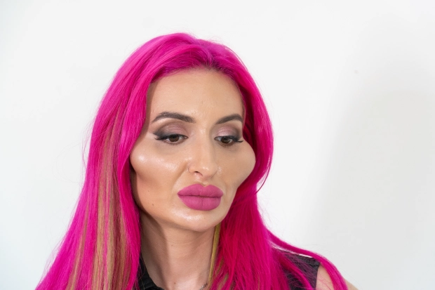 Modelja e Instagramit me mollëzat më të mëdha në botë: I adhuroj ato, gjithmonë kam dashur të dukem kështu! 2 7