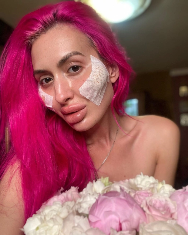 Modelja e Instagramit me mollëzat më të mëdha në botë: I adhuroj ato, gjithmonë kam dashur të dukem kështu! 1 8