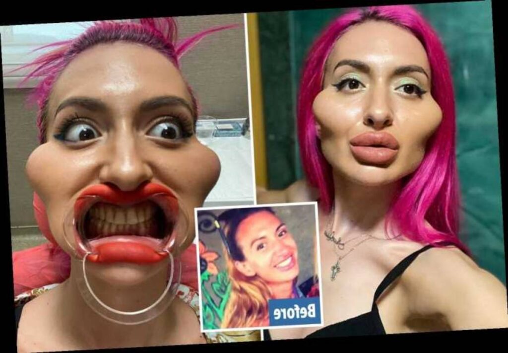 Modelja e Instagramit me mollëzat më të mëdha në botë: I adhuroj ato, gjithmonë kam dashur të dukem kështu! Modelja