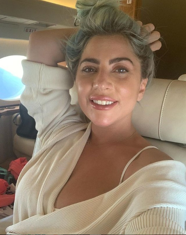 Foto/ Dentistja bëhet VIP në rrjet pasi ka një ngjashmëri shumë të madhe me Lady Gaga-n 2 4