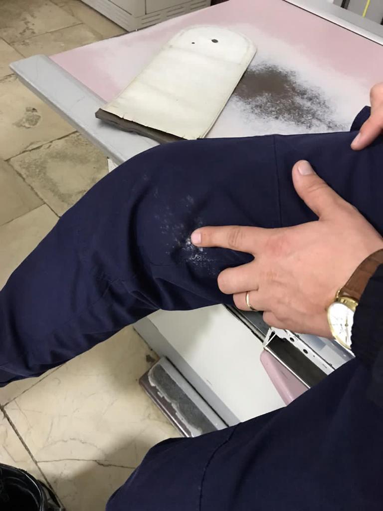 Dalin pamjet nga “Trauma”, punonjësit e policisë që u plagosën gjatë protestës 2 policet te trauma 2