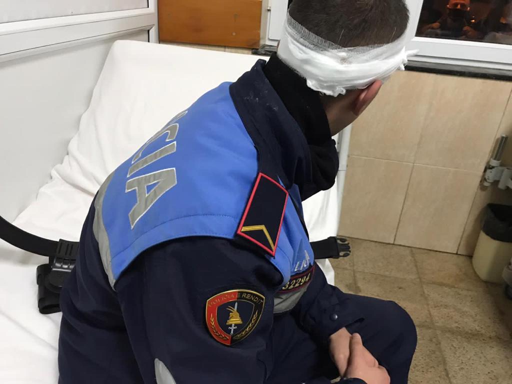 Dalin pamjet nga “Trauma”, punonjësit e policisë që u plagosën gjatë protestës 3 policet te trauma 3