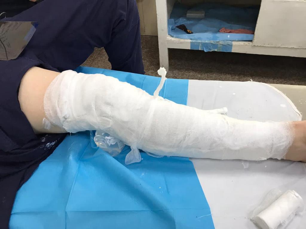 Dalin pamjet nga “Trauma”, punonjësit e policisë që u plagosën gjatë protestës 4 policet te trauma 4