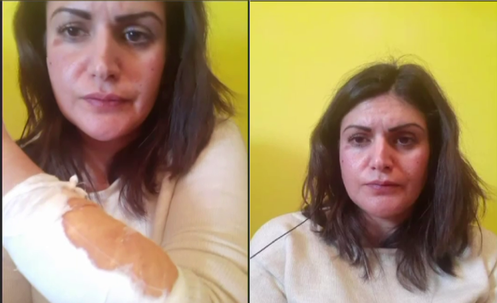 ‘Kam investuar në Shqipëri çdo gjë kisha, ai do të ma marrë’/ Rrëfehet italiania e dhunuar nga burri shqiptar 640 0 6013fb5de4e8a