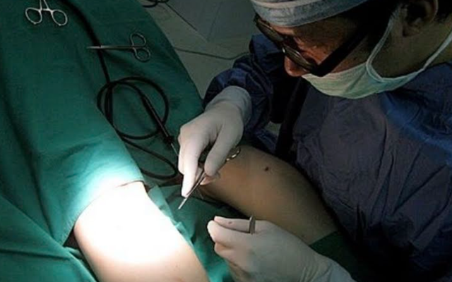 Donte të kishte këmbë të gjata si modelet, shihni çfarë i ndodh kësaj vajze pas operacionit të ndërlikuar 640 0 6013ffd582a62