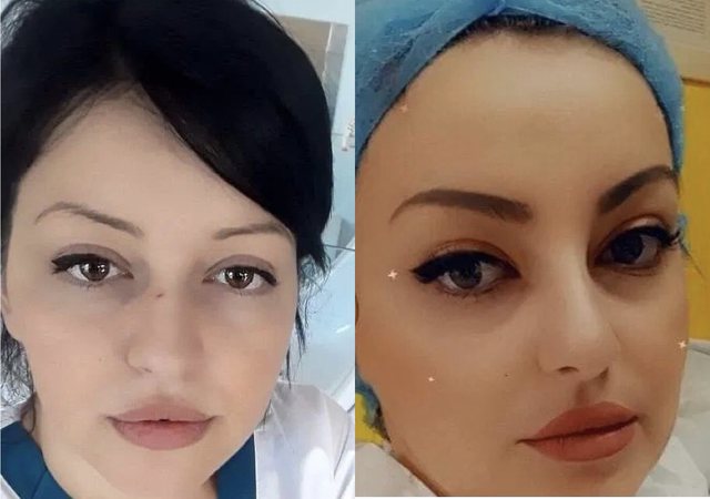 E lyer dhe e kuruar në orarin e punës, kjo është infermierja që bashkëpunoi me Tiren (FOTOT) Sidorela Cela 3