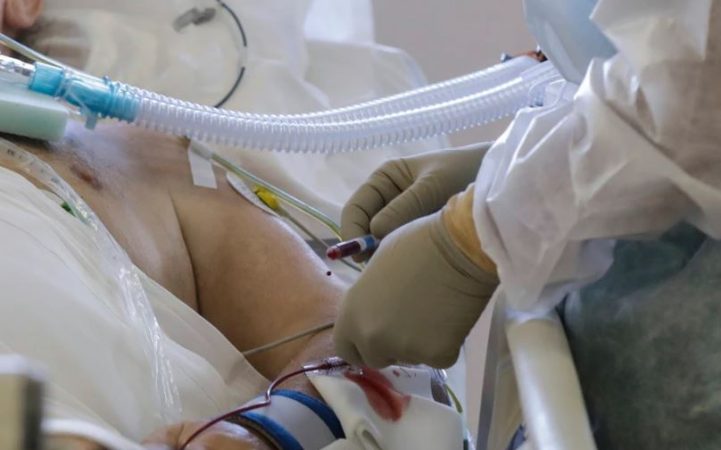 Ja 4 sëmundjet kronike, që shkaktojnë nevojën e shtrimeve në spital për Covid-19 covid1 721x450 1