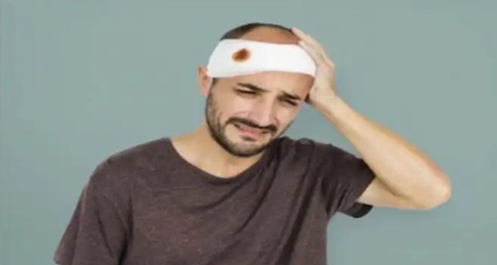 dhimbje koke