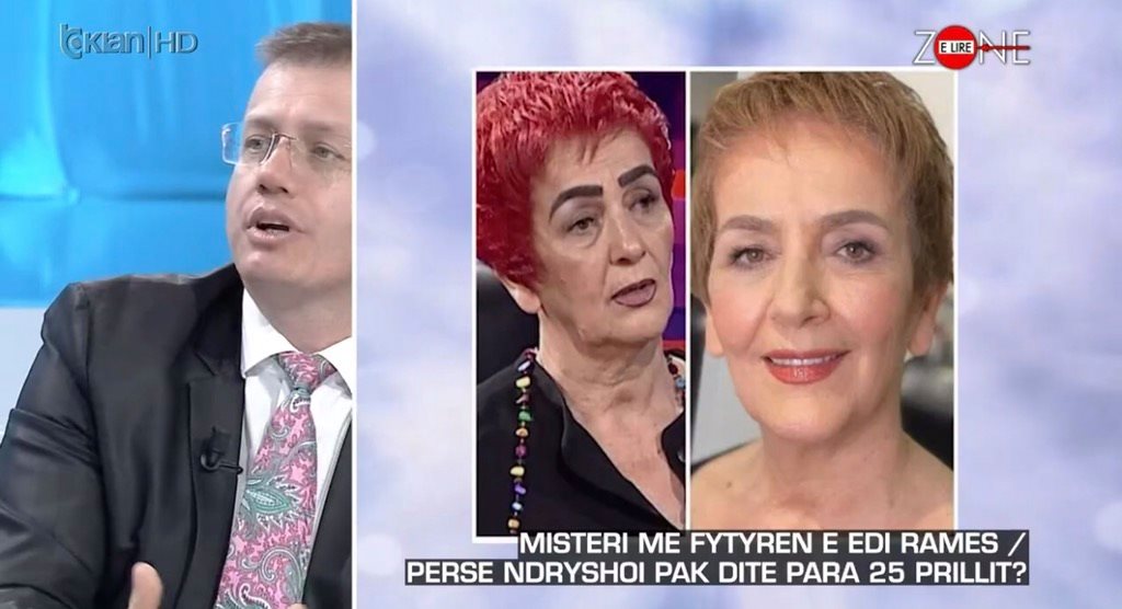 A ka bërë Najada Çomo ndërhyrje në fytyrë? Çfarë thotë kirurgu estetik Panajot Papa najada