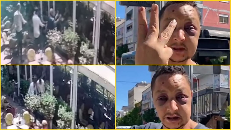 Momenti kur kamarierët dhunojnë me grushte kokës e në bark emigrantin nga Maroku Pamje nga dhunimi i marokenit