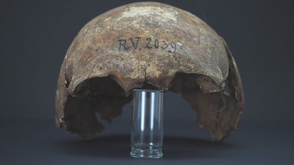 Shkencëtarët zbulojnë “pacientin zero” të murtajës, vdiq 5 mijë vjet më parë 119138912 skull
