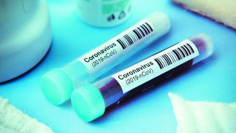 Mali i zi ashpërson masat anti-Covid, kërkon certifikatë vaksinimi ose test PCR koronavirusi 2 770x433 1