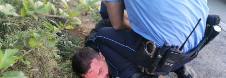 I shtrirë dhe gjakosur në kokë, arrestohet bashkëshorti i ish-ministres Besa Shahini Screenshot 6 9 770x265 1